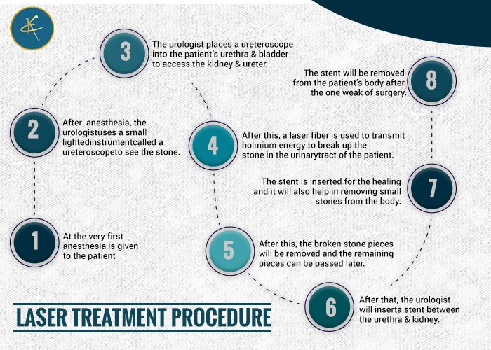 Laser Treatment Procedure
